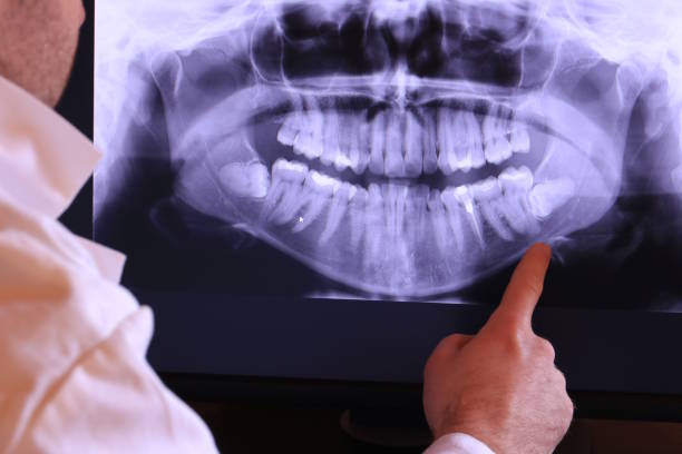 Trusted KY Emergency Dental Service Experts
